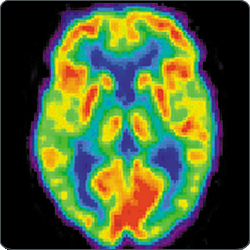 Positron emission tomography is one thing you could do